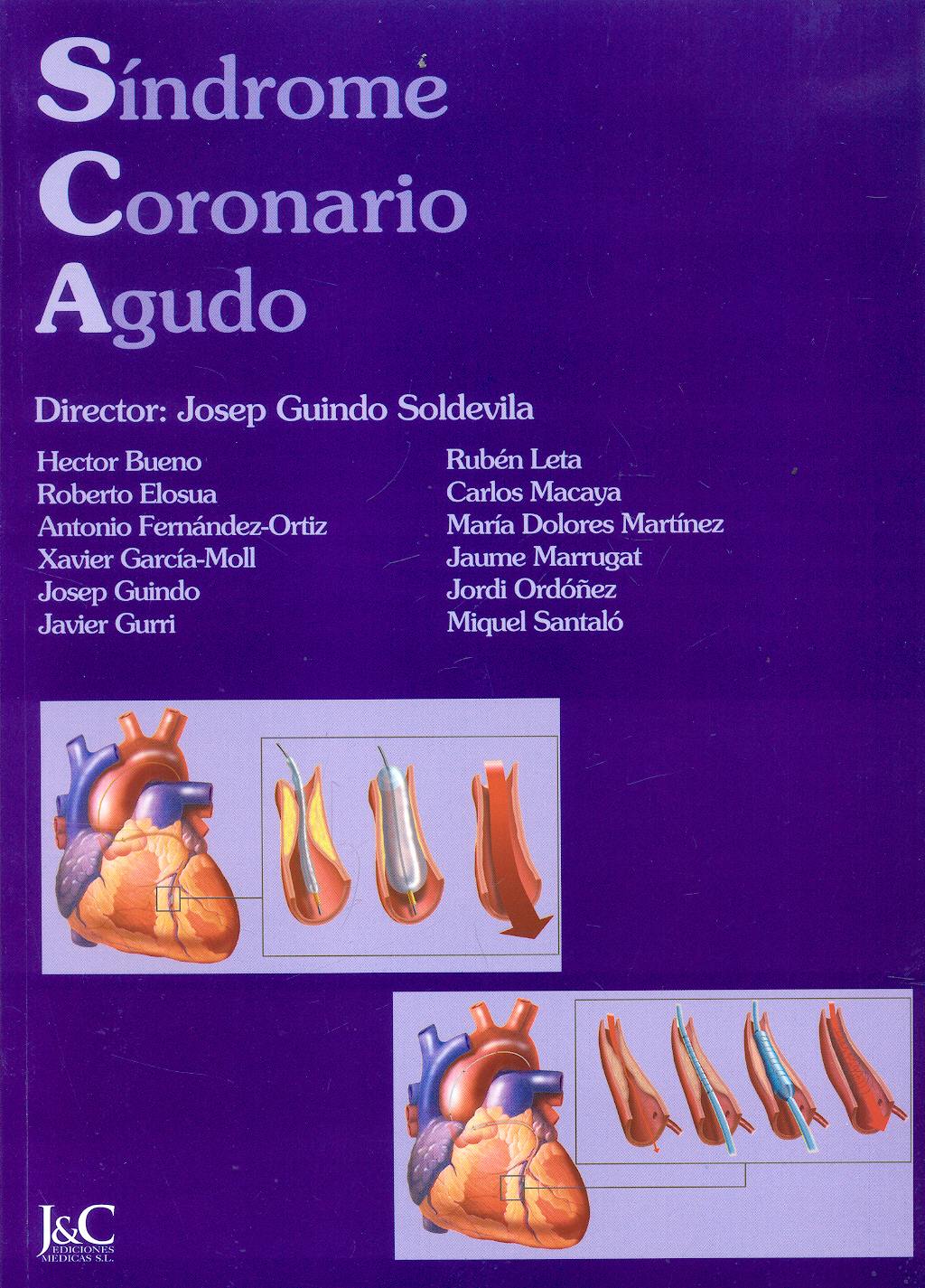 Portada del libro 9788495182265 Sindrome Coronario Agudo