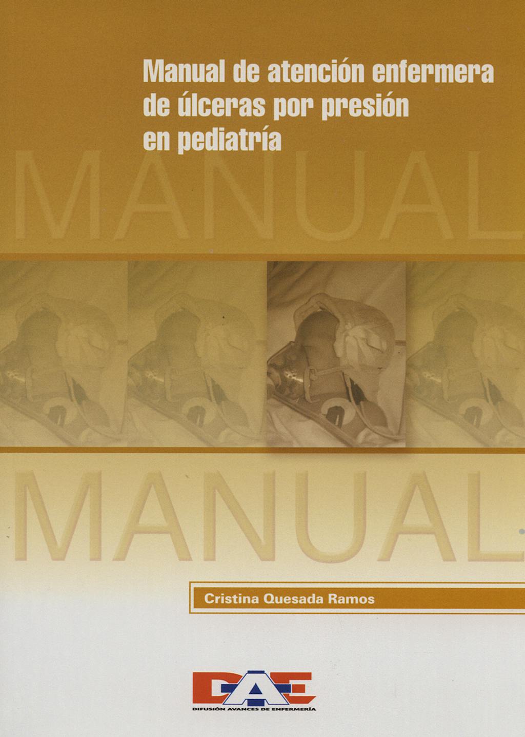 Portada del libro 9788495626349 Manual de Atencion Enfermera de Ulceras por Presion en Pediatria