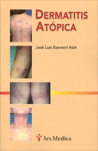 Portada del libro 9788495670113 Dermatitis Atopica