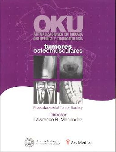 Portada del libro 9788495670229 OKU Actualizaciones en Cirugía Ortopédica y Traumatología. Tumores Osteomusculares