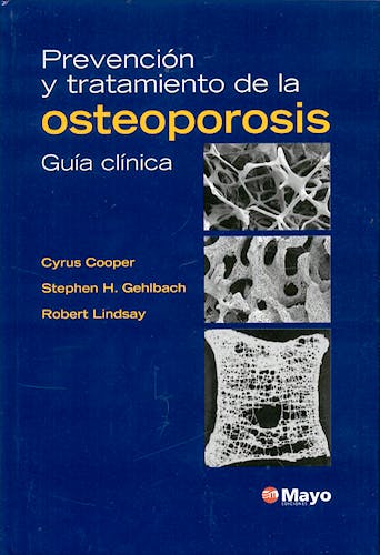 Portada del libro 9788496537293 Prevencion y Tratamiento de la Osteoporosis