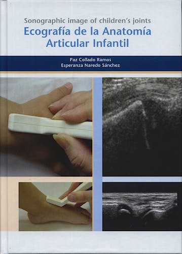 Portada del libro 9788496727311 Ecografia de la Anatomia Articular Infantil (Español/ingles)
