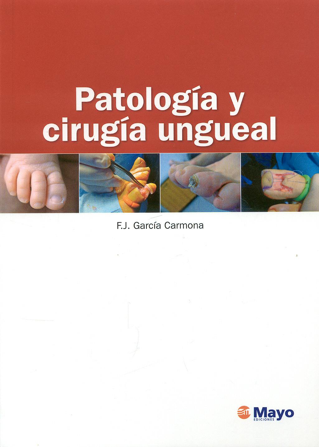 Portada del libro 9788496792975 Patología y Cirugía Ungueal