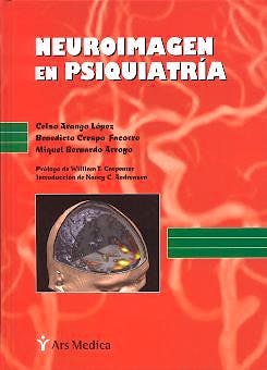 Portada del libro 9788497060561 Neuroimagen en Psiquiatria