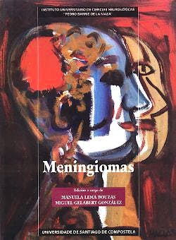 Portada del libro 9788497500319 Meningiomas