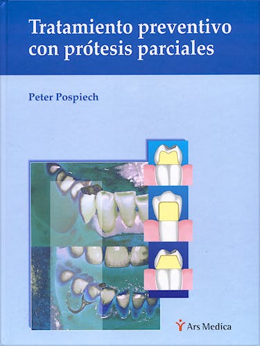Portada del libro 9788497510134 Tratamiento Preventivo con Prótesis Parciales