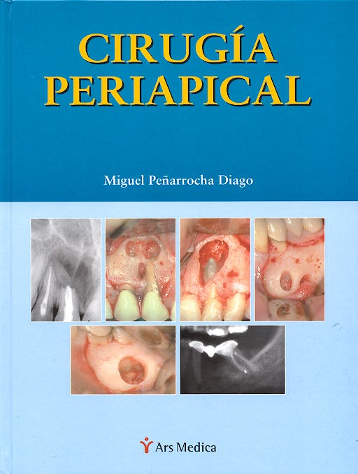 Portada del libro 9788497510301 Cirugia Periapical