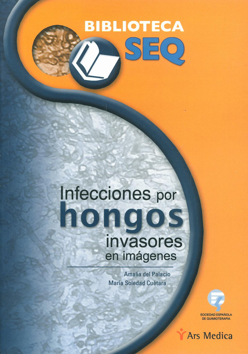 Portada del libro 9788497513562 Infecciones por Hongos Invasores en Imágenes