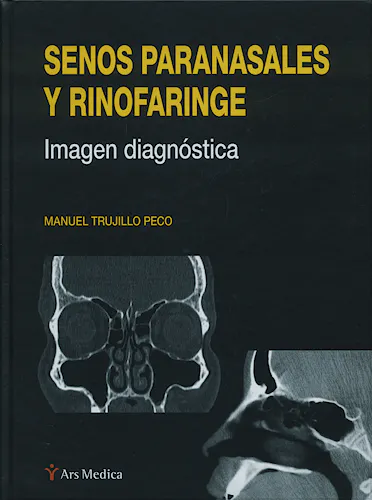 Portada del libro 9788497513852 Senos Paranasales y Rinofaringe. Imagen Diagnostica