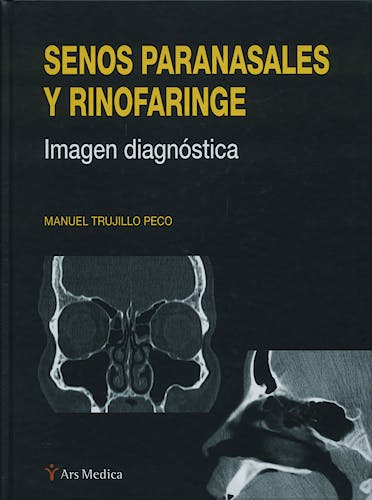 Portada del libro 9788497513852 Senos Paranasales y Rinofaringe. Imagen Diagnostica