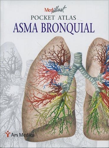 Portada del libro 9788497514224 Pocket Atlas Asma Bronquial