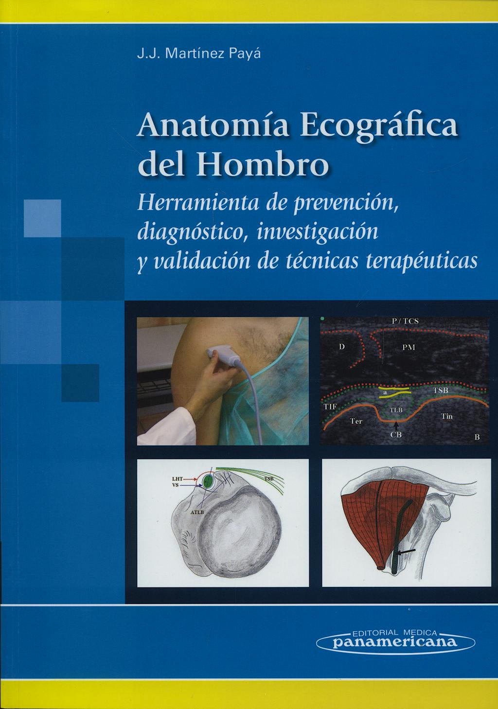 Portada del libro 9788498350548 Anatomia Ecografica del Hombro. Herramienta de Prevencion, Diagnostico, Investigacion y Validacion de Tecnicas Terapeuticas.