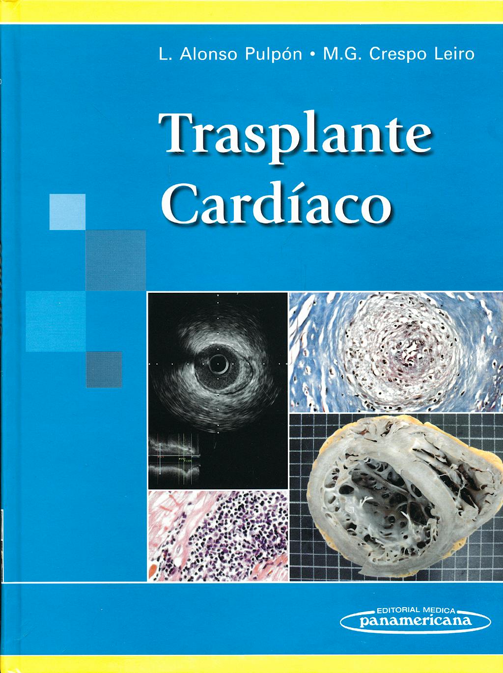 Portada del libro 9788498351071 Trasplante Cardiaco