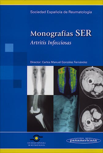 Portada del libro 9788498351453 Artritis Infecciosas. Monografías SER