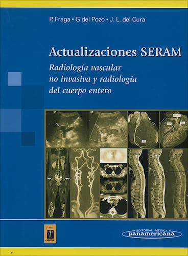 Portada del libro 9788498351651 Actualizaciones SERAM. Radiología Vascular no Invasiva y Radiología del Cuerpo Entero