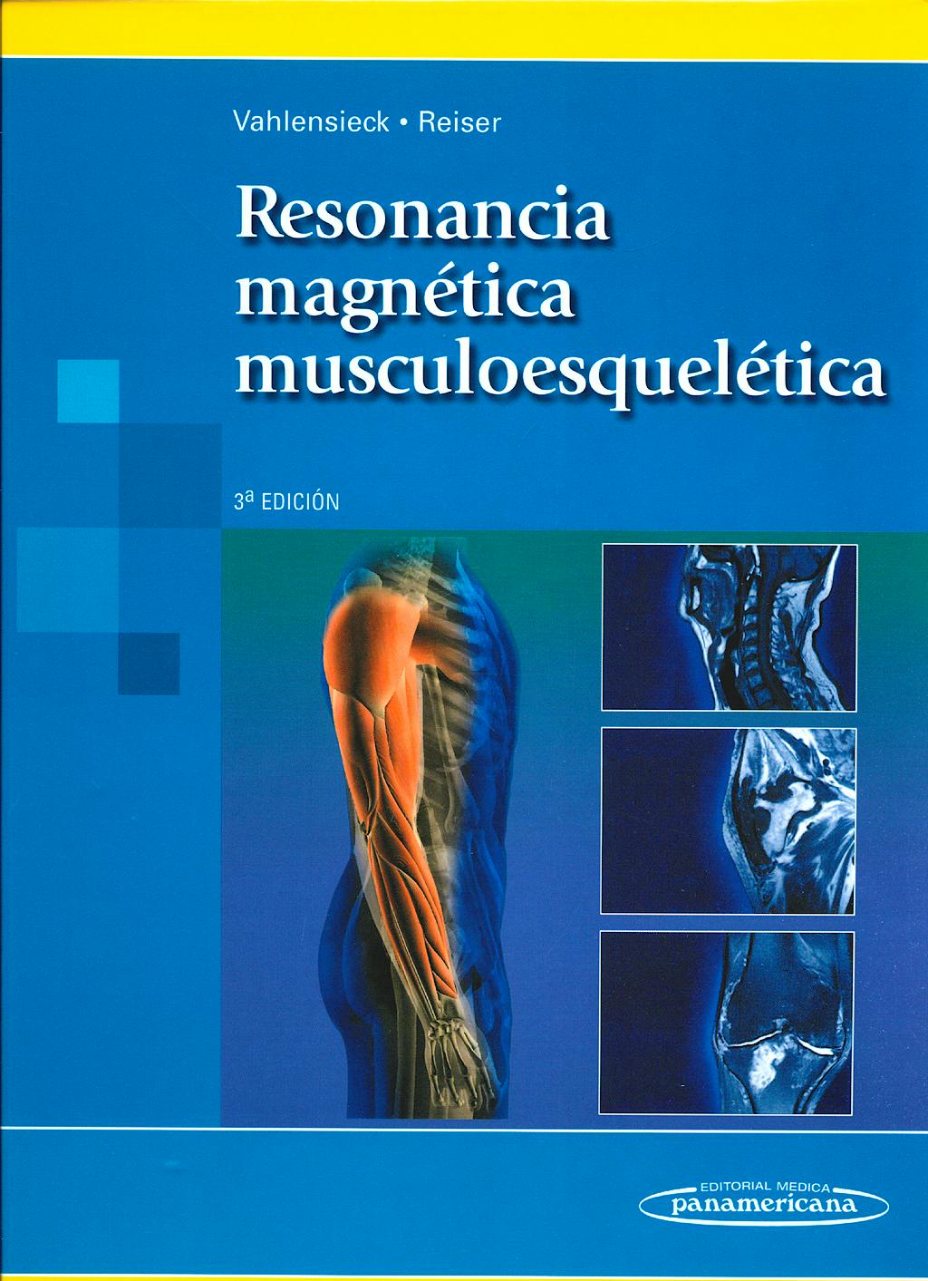 Portada del libro 9788498352047 Resonancia Magnética Musculoesquelética