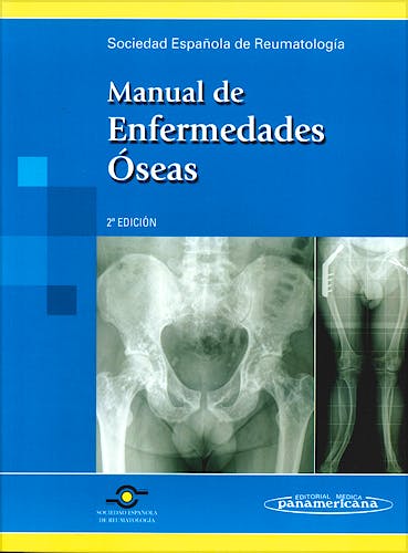 Portada del libro 9788498352306 Manual de Enfermedades Oseas