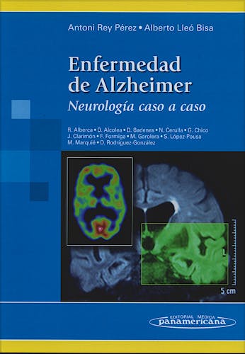 Portada del libro 9788498352634 Enfermedad de Alzheimer. Neurologia caso a Caso