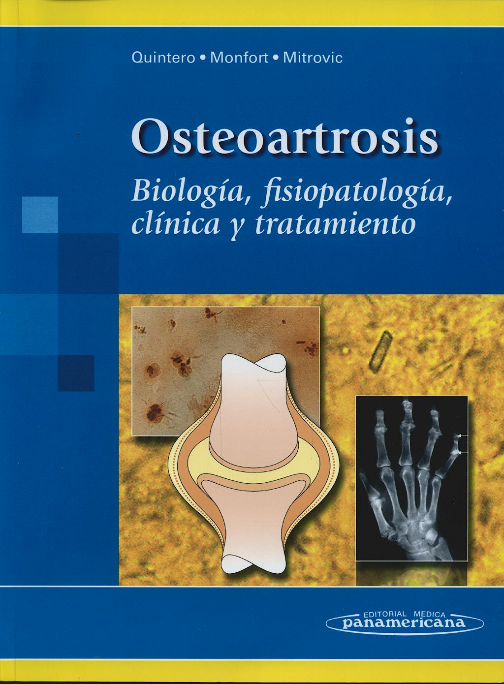 Portada del libro 9788498352672 Osteoartrosis. Biologia, Fisiopatologia, Clinica y Tratamiento