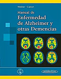 Portada del libro 9788498353228 Manual de Enfermedad de Alzheimer y Otras Demencias