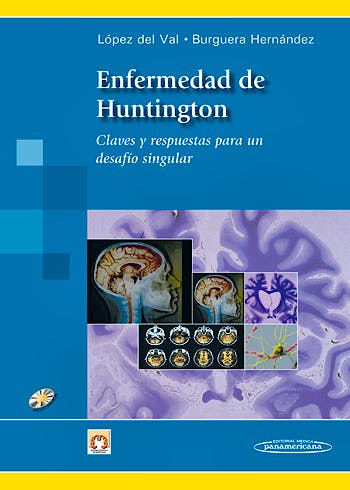 Portada del libro 9788498353525 Enfermedad de Huntington. Claves y Respuestas para un Desafio Singular + Dvd