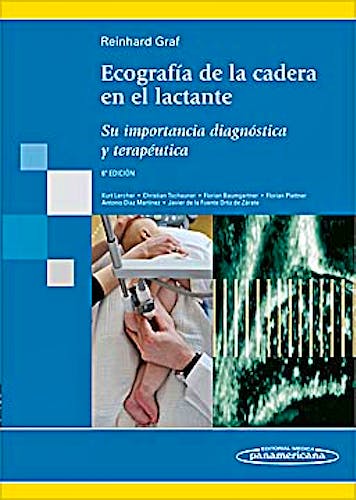 Portada del libro 9788498353877 Ecografia de la Cadera en el Lactante. Su Importancia Diagnostica y Terapeutica