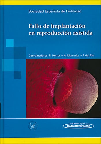 Portada del libro 9788498355680 Fallo de Implantacion en Reproduccion Asistida