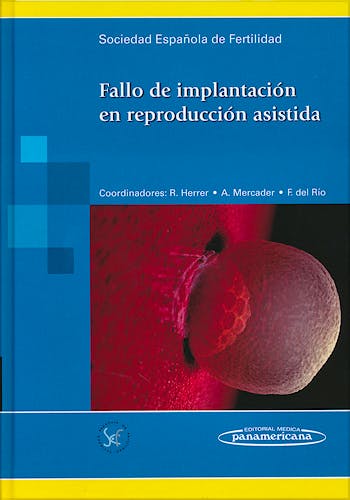Portada del libro 9788498355680 Fallo de Implantacion en Reproduccion Asistida