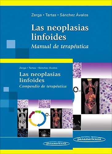Portada del libro 9788498357523 Las Neoplasias Linfoides (Manual de Terapeutica + Compendio de Terapeutica)