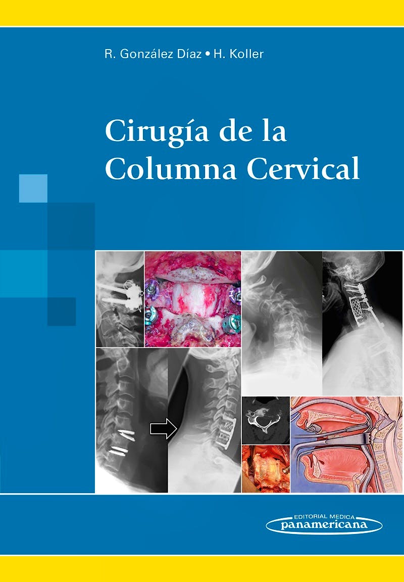 Portada del libro 9788498358087 Cirugía de la Columna Cervical