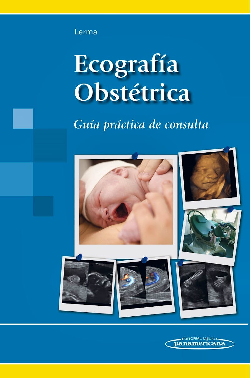 Portada del libro 9788498358148 Ecografía Obstétrica. Guía Práctica de Consulta