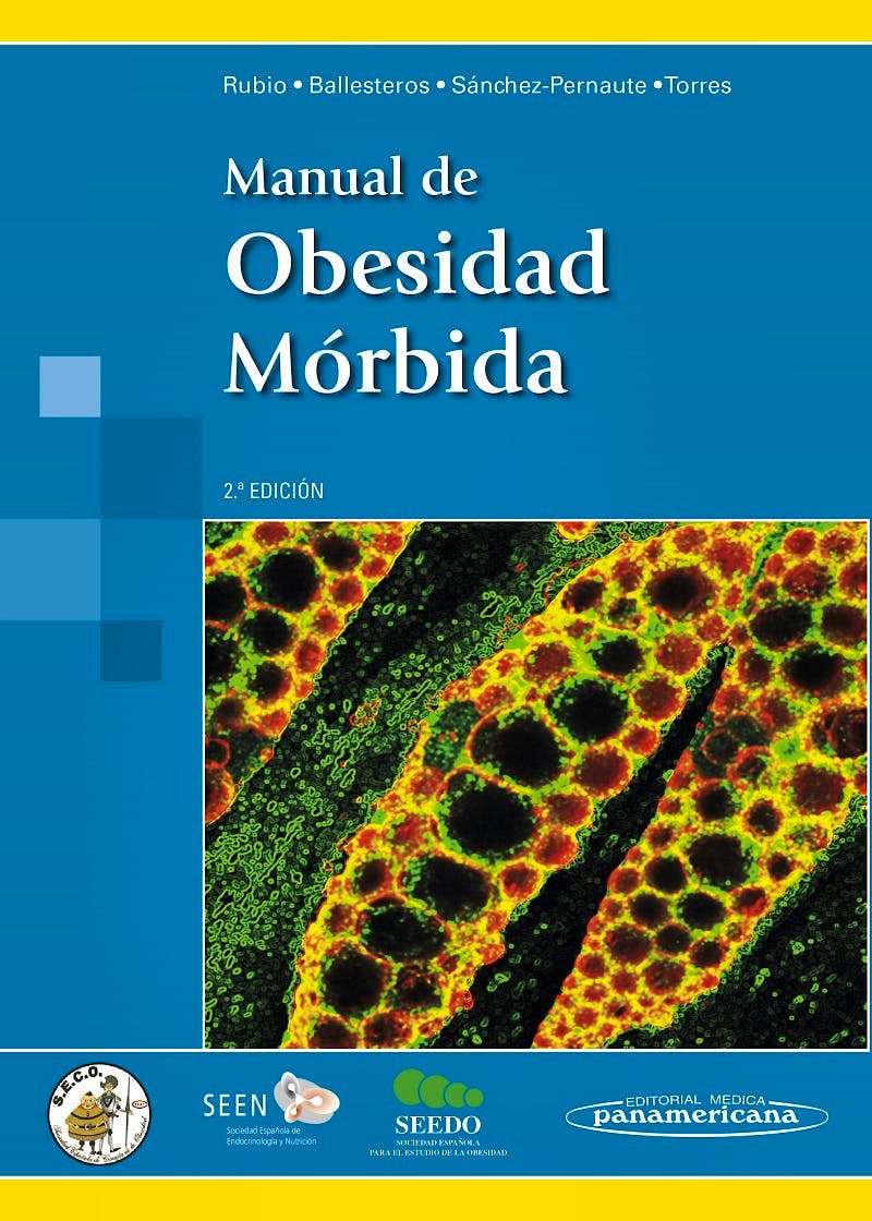 Portada del libro 9788498358476 Manual de Obesidad Mórbida