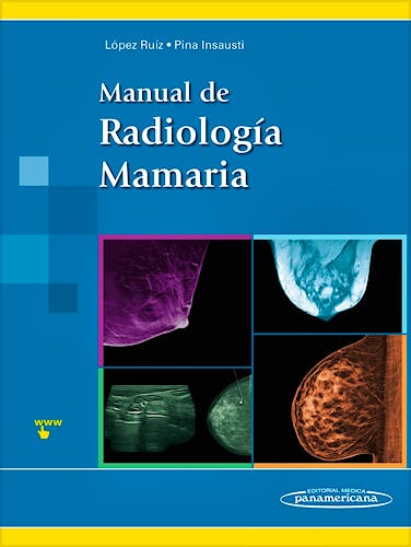 Portada del libro 9788498359336 Manual de Radiología Mamaria