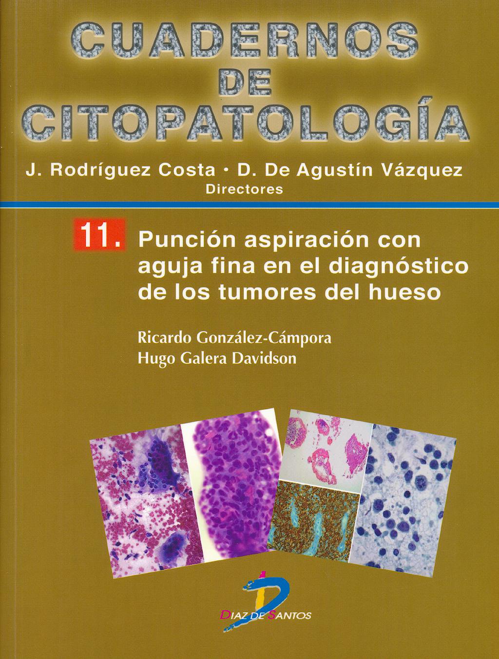 Portada del libro 9788499694221 Cuadernos de Citopatología 11: Punción Aspiración con Aguja Fina en el Diagnóstico de los Tumores del Hueso