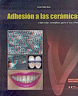 Portada del libro 9788536700953 Adhesion a las Ceramicas. Evidencias Cientificas para el Uso Clinico (Imagenes en 3d, Gafas Incluidas)