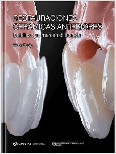 Portada del libro 9788548001093 Restauraciones Cerámicas Anteriores. Detalles que Marcan Diferencia