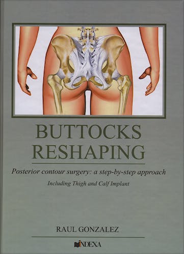 Portada del libro 9788560138005 Buttocks Reshaping. Posterior Contour Surgery: A Step by Step Approach