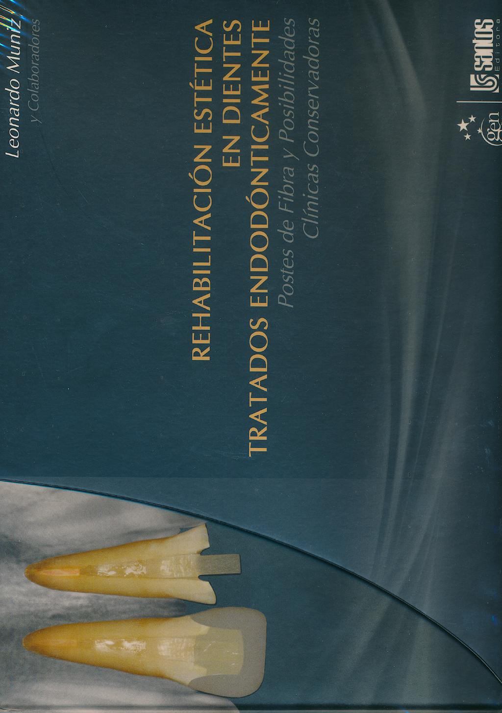 Portada del libro 9788572888813 Rehabilitacion Estetica en Dientes Tratados Endodonticamente. Postes de Fibra y Posibilidades Clinicas Conservadoras