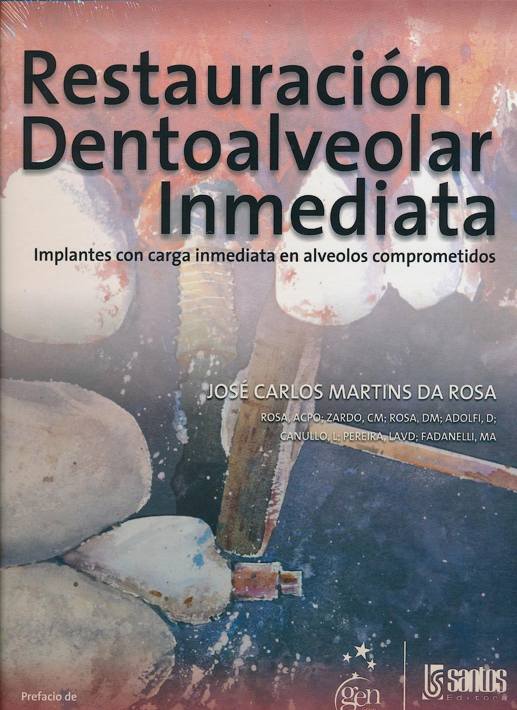 Portada del libro 9788572889490 Restauración Dentoalveolar Inmediata. Implantes con Carga Inmediata en Alveolos Comprometidos