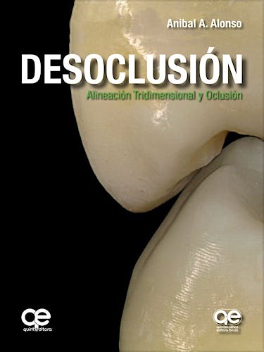 Portada del libro 9788578891770 Desoclusión. Alineación Tridimensional y Oclusión