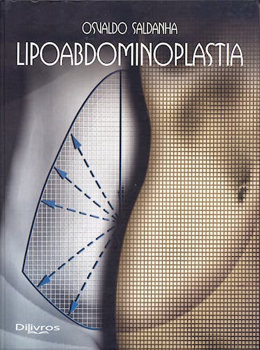Portada del libro 9788586703140 Lipoabdominoplastia (En Portugues)