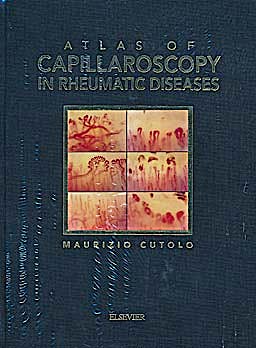 Portada del libro 9788821432033 Atlas of Capillaroscopy in Rheumatic Diseases