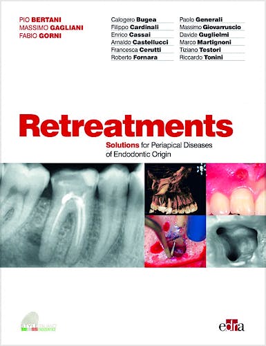 Portada del libro 9788821450938 Retreatments. Solutions for Periapical Diseases of Endodontic Origin