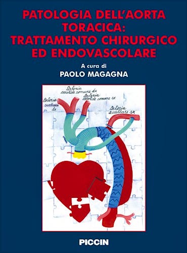Portada del libro 9788829922901 Patologia Dell'aorta Toracica: Trattamento Chirurgico Ed Endovascolare