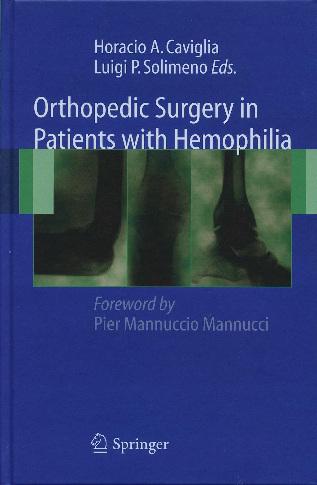 Portada del libro 9788847008533 Orthopedic Surgery in Patients with Hemophilia