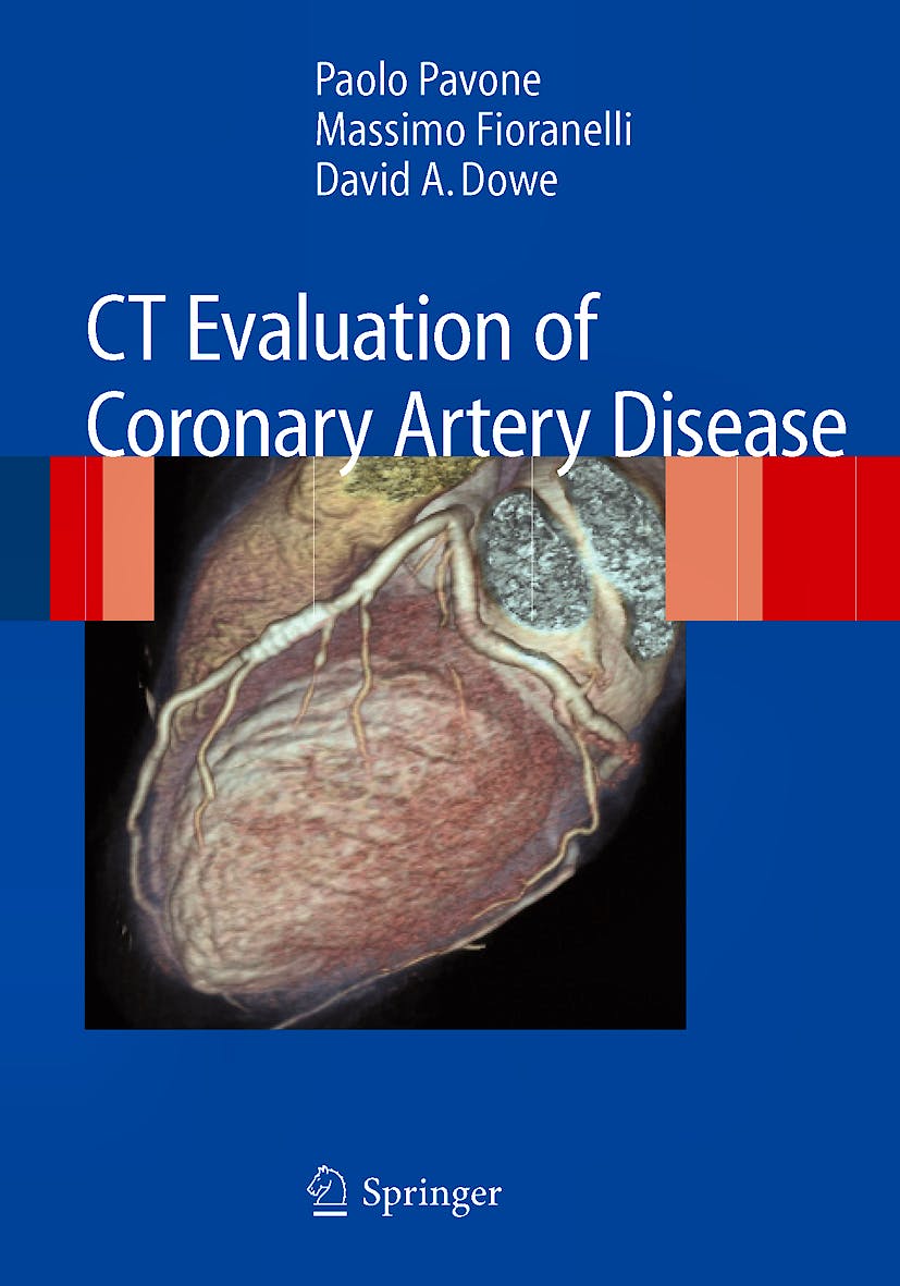 Portada del libro 9788847011250 Ct Evaluation of Coronary Artery Disease