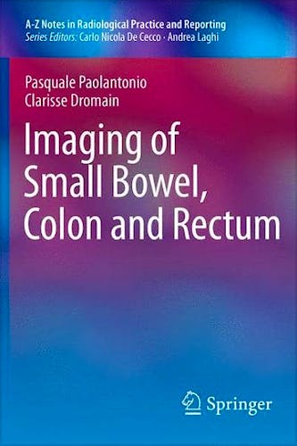 Portada del libro 9788847054882 Imaging of Small Bowel, Colon and Rectum (A-Z Notes in Radiological Practice and Reporting)