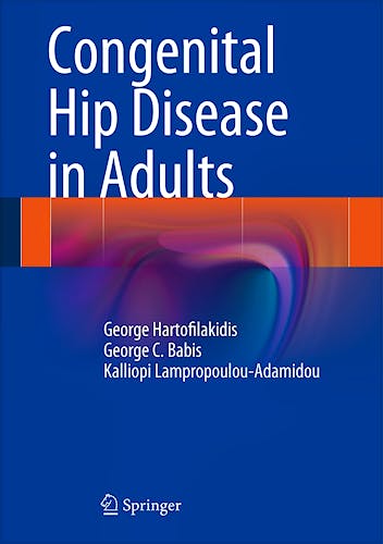 Portada del libro 9788847054912 Congenital Hip Disease in Adults