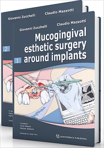 Portada del libro 9788874920914 Mucogingival Esthetic Surgery Around Implants (2 Volume Set)