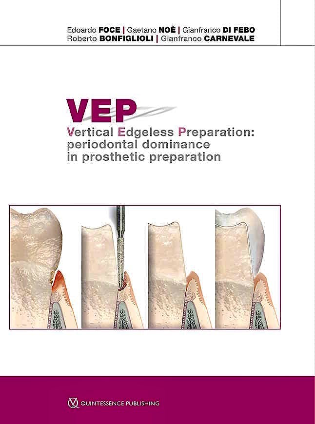 Portada del libro 9788874922130 VEP Vertical Edgeless Preparation: Periodontal Dominance in Prosthetic Preparation
